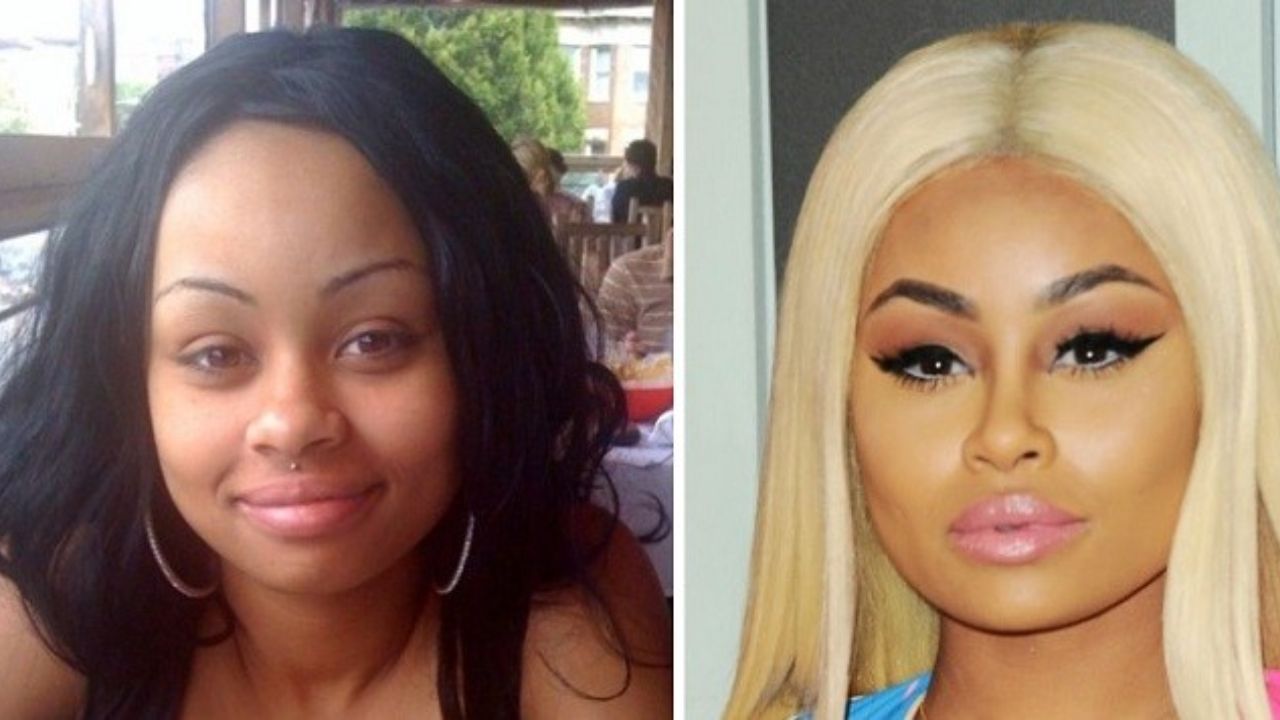 Blac Chyna's Plastic Surgery: Before and After Transformation Examined!