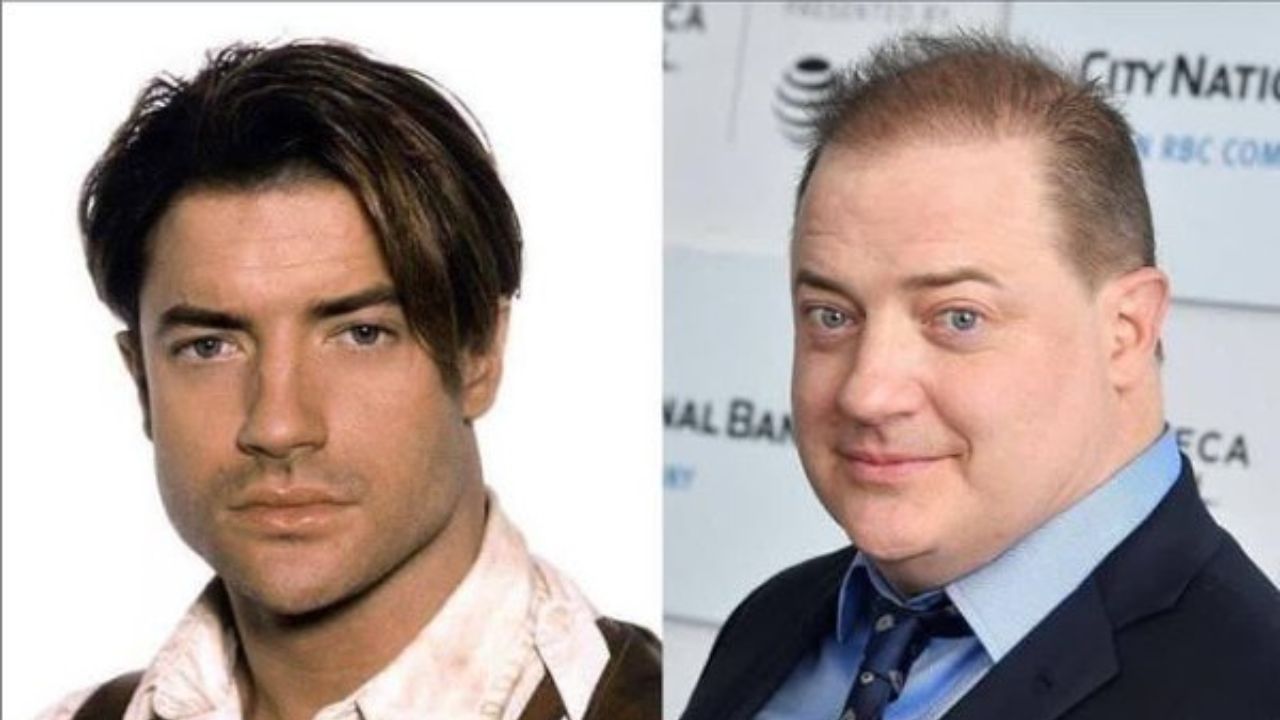 Brendan Fraser's Weight Gain in 2022: What Disease Does the Actor Have?