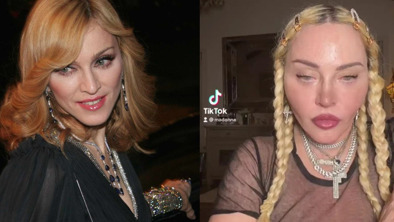 Reddit: Madonna's Plastic Surgery in 2022 Includes Implants & Facelifts!