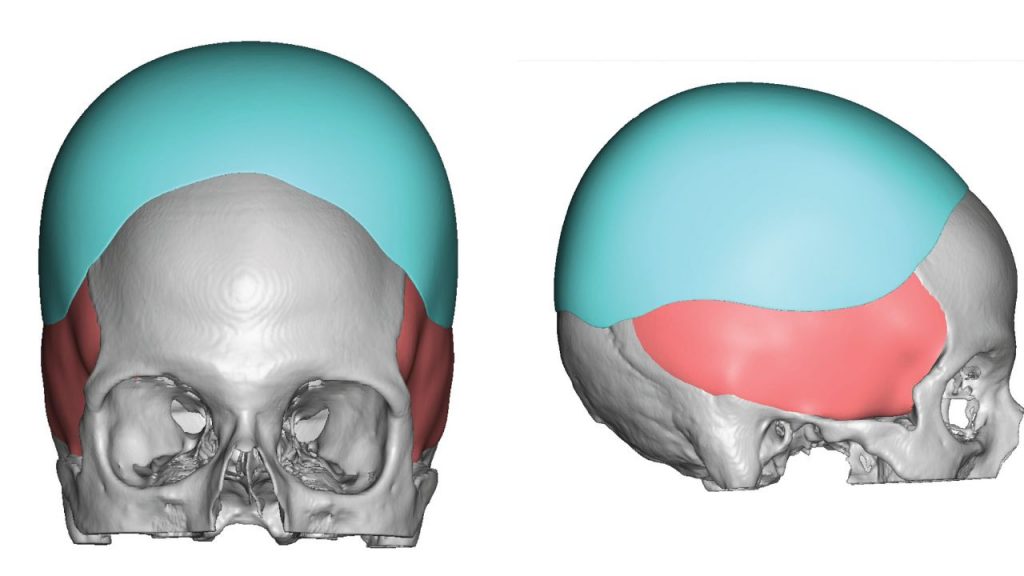 Cranial Occipital Plastic Surgery: Done For Cosmetic Purposes!