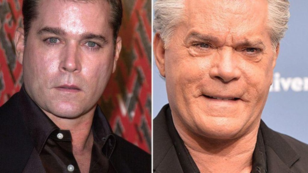 Ray Liotta's Plastic Surgery: Fans Wonder About His Health Prior to His Death!