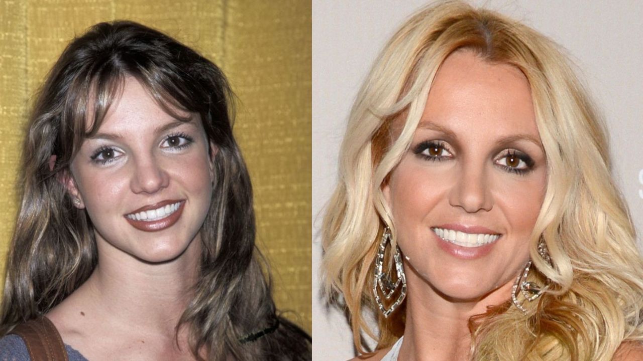 Britney Spears' Plastic Surgery: Then and Now Pictures of The Singer!