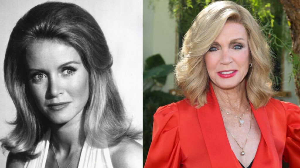 Donna Mills’ Plastic Surgery: Before and After Changes Examined!