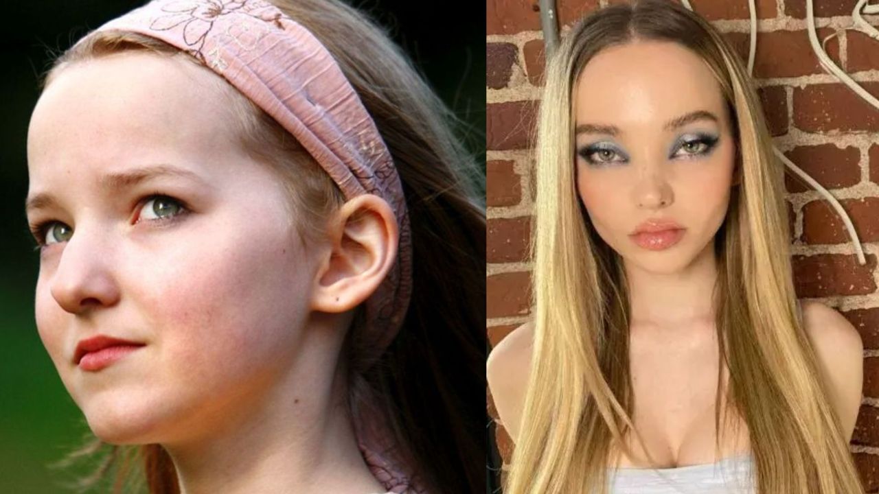 Did Dove Cameron Get Plastic Surgery? Check Out The Descendants Star's Before And After Pictures!