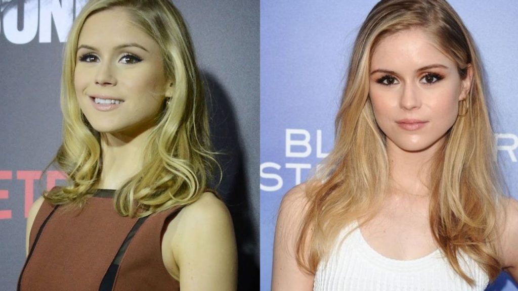 Erin Moriarty’s Plastic Surgery & Nose Job The Boys’ Starlight Actress