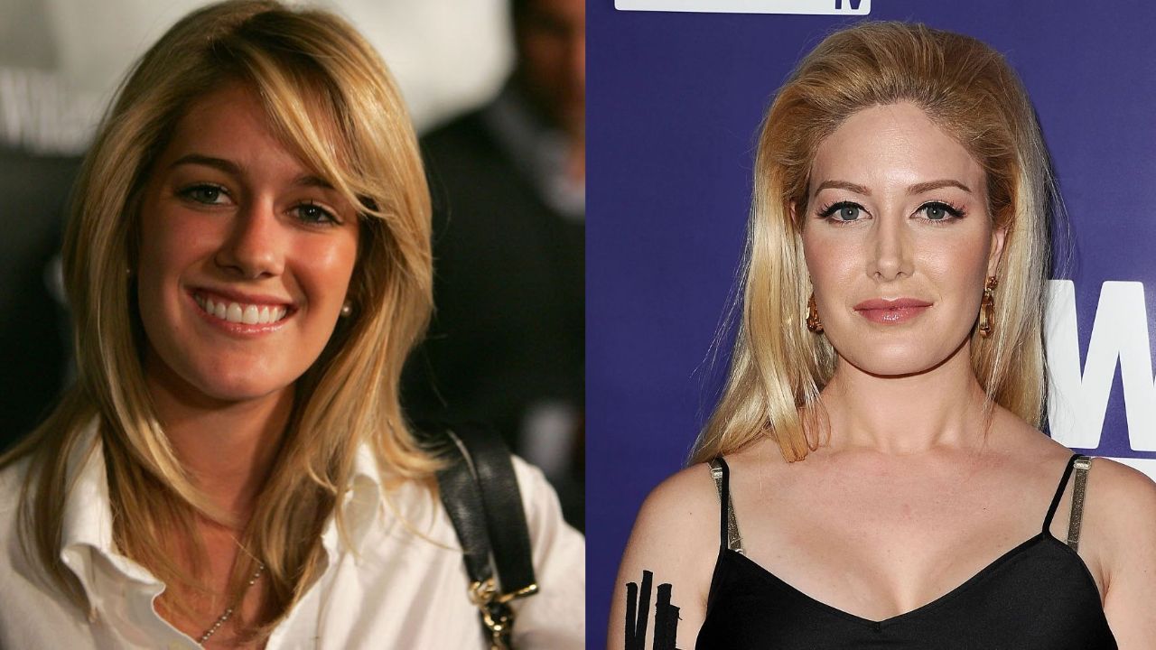 Heidi Montag's Plastic Surgery: Check Out The Hills Star's Before and After Pictures!
