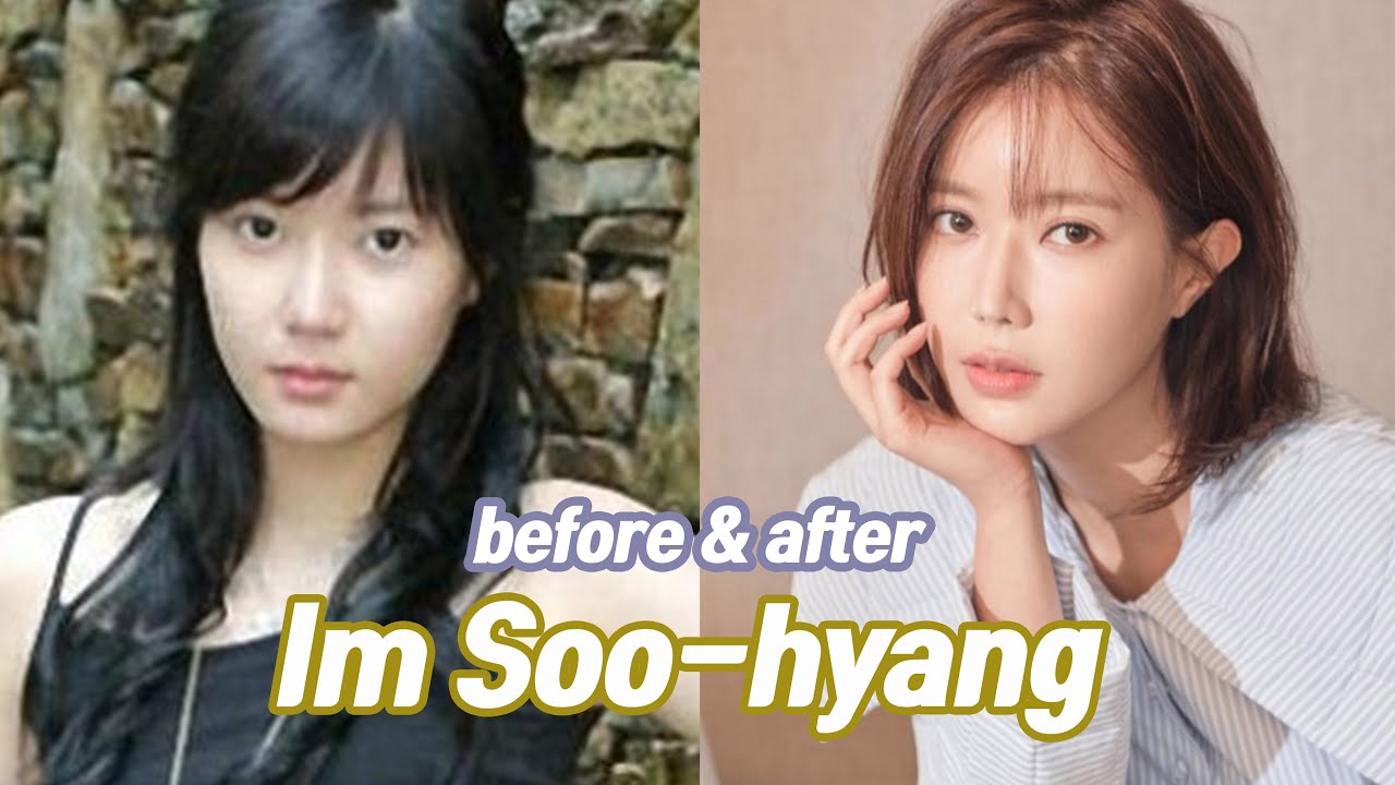Im Soo-hyang Before Plastic Surgery: Has the Woori the Virgin Star Undergone Any Cosmetic Enhancement?