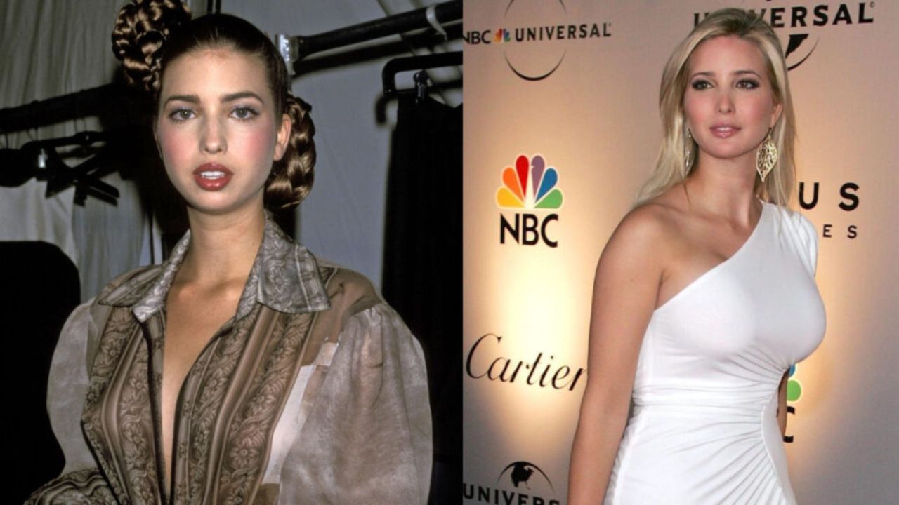 Ivanka Trump Before Plastic Surgery: Speculations of Rhinoplasty, Botox & Boob Job; Before & After Pictures Examined!