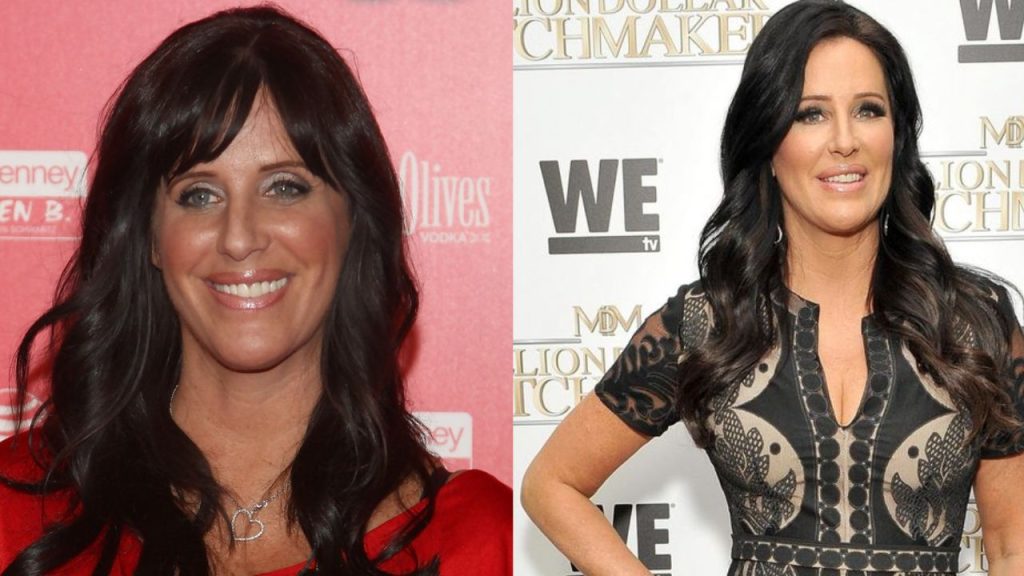 Patti Stanger's Plastic Surgery: Before And After Photos & Plastic Surgeon Explored!