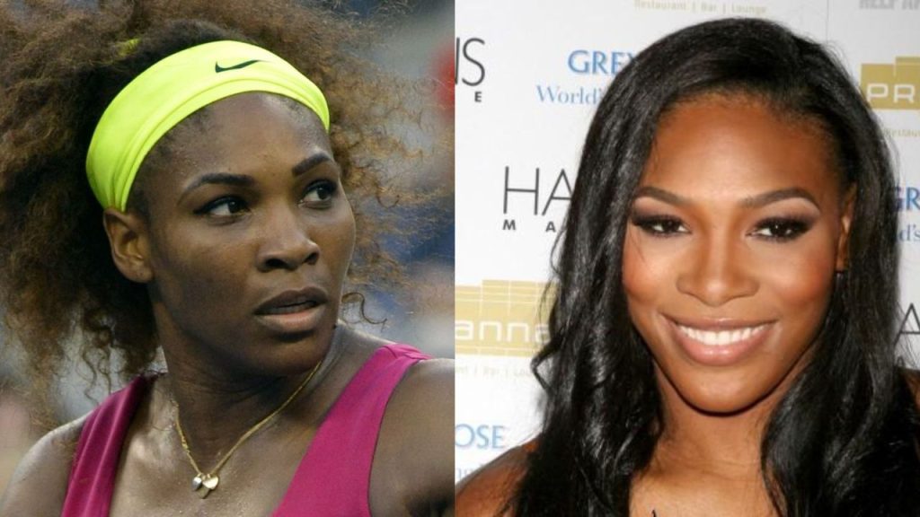Serena Williams' Plastic Surgery: Rumors of A Nose Job, Breast Implants, and Butt Augmentation!