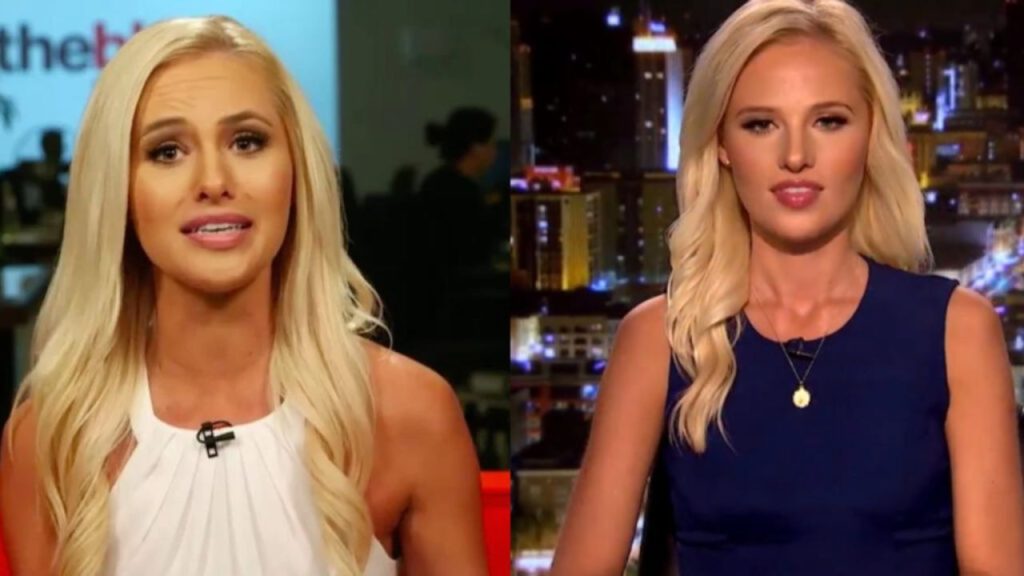 Tomi Lahren's Plastic Surgery: Before And After Changes Examined!