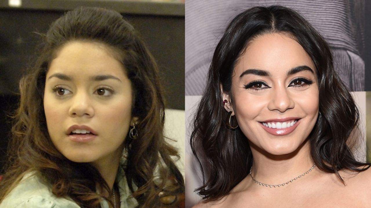 Vanessa Hudgens' Plastic Surgery: From a Young Disney Star to a Fashion Icon, Here’s How Vanessa Hudgens’s Face Changed!