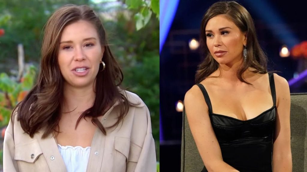The Bachelorette 2022: Gabby Windey's Plastic Surgery; Botox and Lip Fillers Speculations!