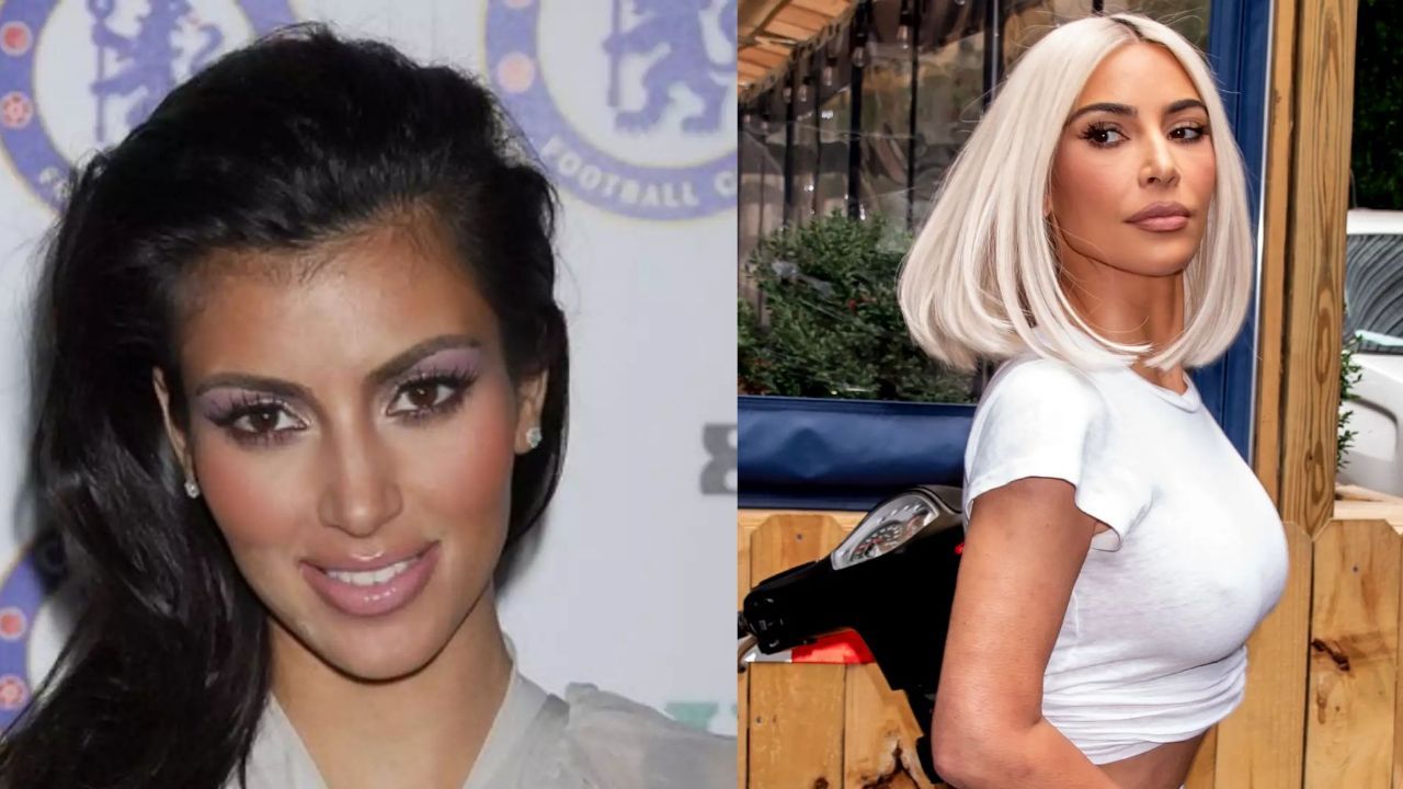 Allure: Kim Kardashian’s Plastic Surgery Confession in 2022; Before & After Pictures Analyzed!