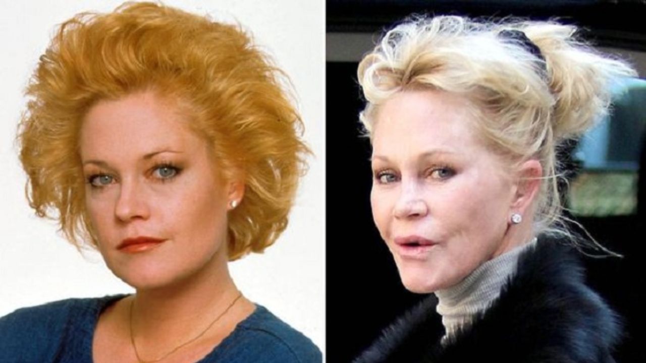 Melanie Griffith's Plastic Surgery: The Untold Truth!