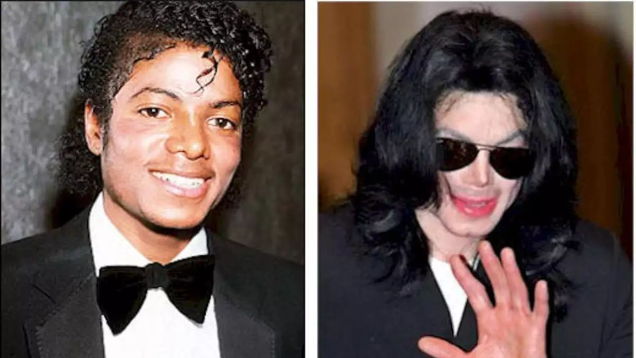 Michael Jackson's Plastic Surgery Evolution: How Many Plastic Surgeries Did Michael Have?