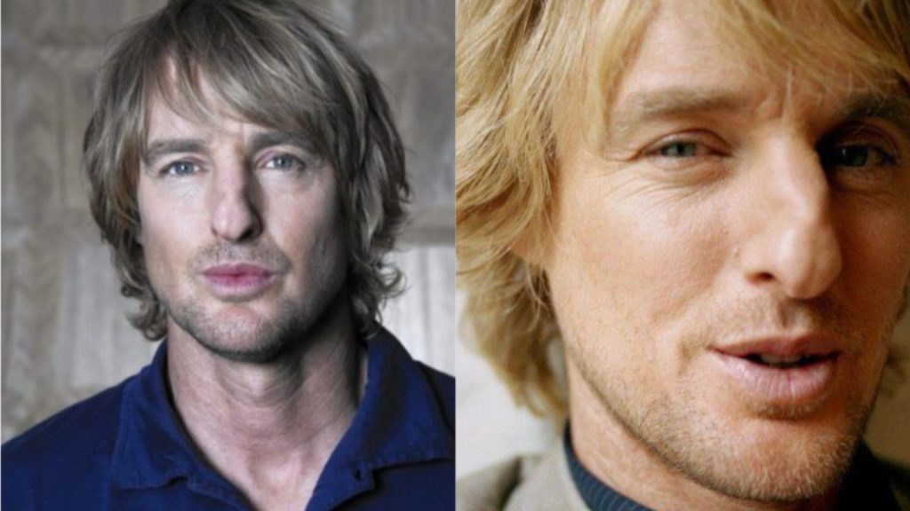 Owen Wilson's Plastic Surgery: Marry Me Star Before and After Cosmetic Changes!
