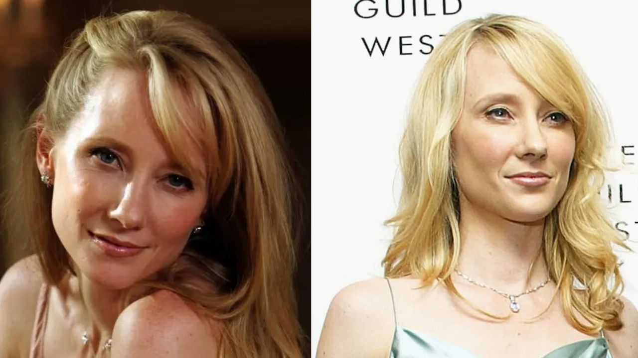 Anne Heche's Plastic Surgery: Rumors of Botox, Nose Job, and Facelift!