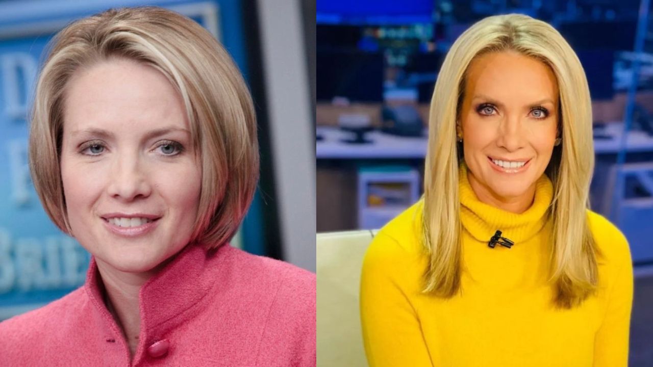 Dana Perino's Plastic Surgery: Rumors of Facelift, Nose Job, Botox, and More; Check Out Before and After Pictures!