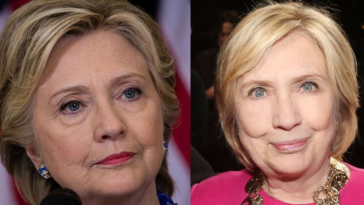 Hillary Clinton's Plastic Surgery: The Former First Lady of America Looks Very Different These Days; Check Out The Before and After Pictures!