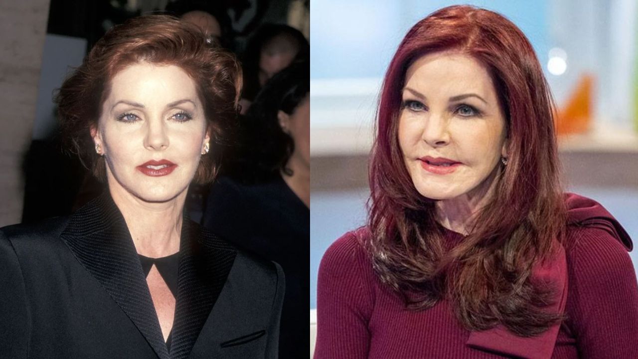 Priscilla Presley's Plastic Surgery: The Actress Had Botched Botox Treatment; Look at The Before and After Pictures!