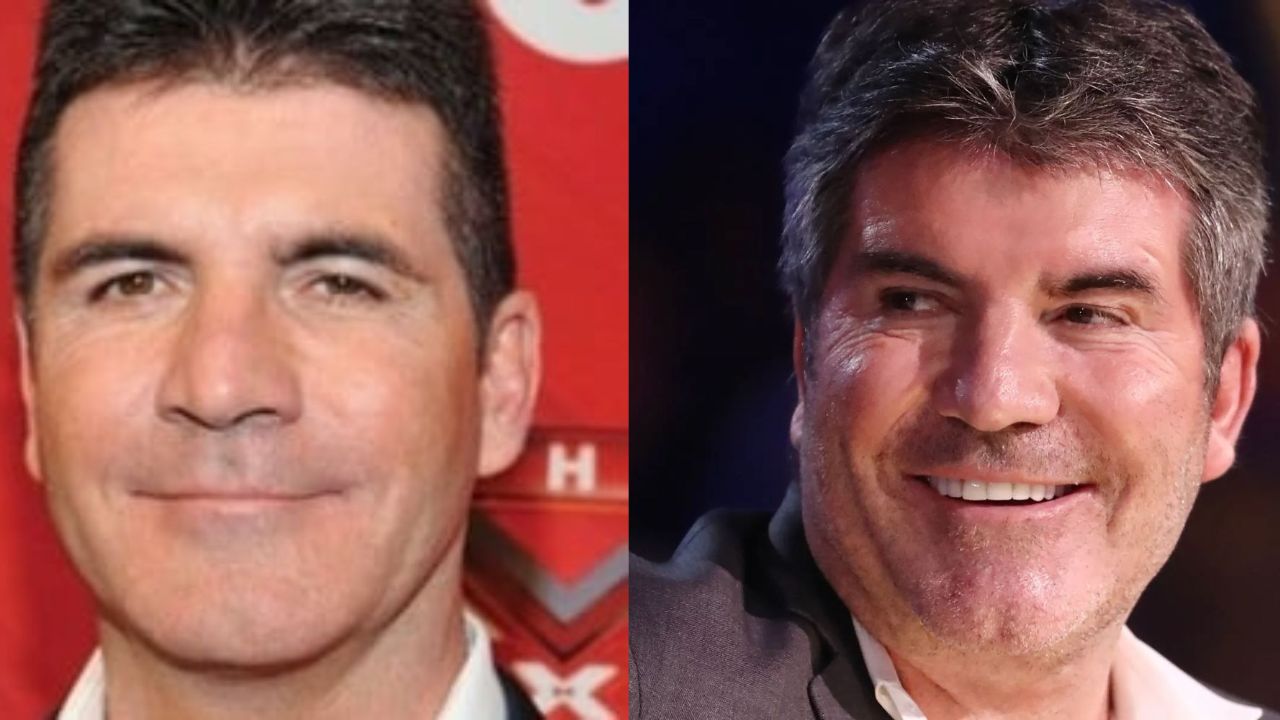 Simon Cowell's Plastic Surgery: The X Factor Creator Before and After Botox, Fillers, and Facelift!