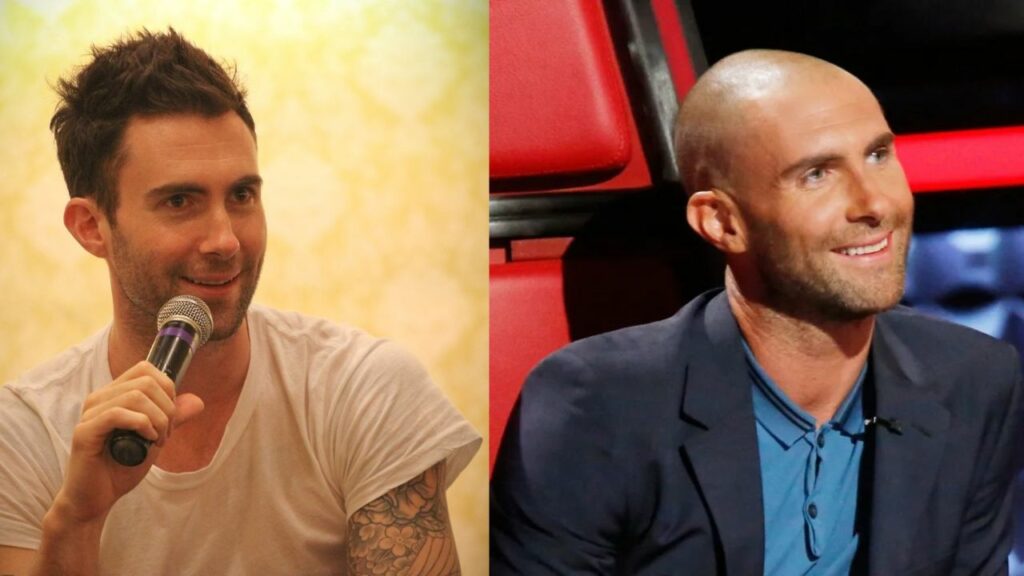 Adam Levine's Plastic Surgery: Did The Maroon 5 Singer Have a Hair Transplant?