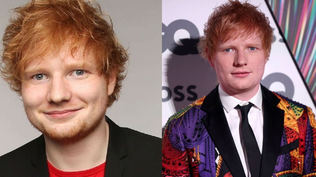 Ed Sheeran's Plastic Surgery: Did The Singer Choose to Have Cosmetic Surgery?