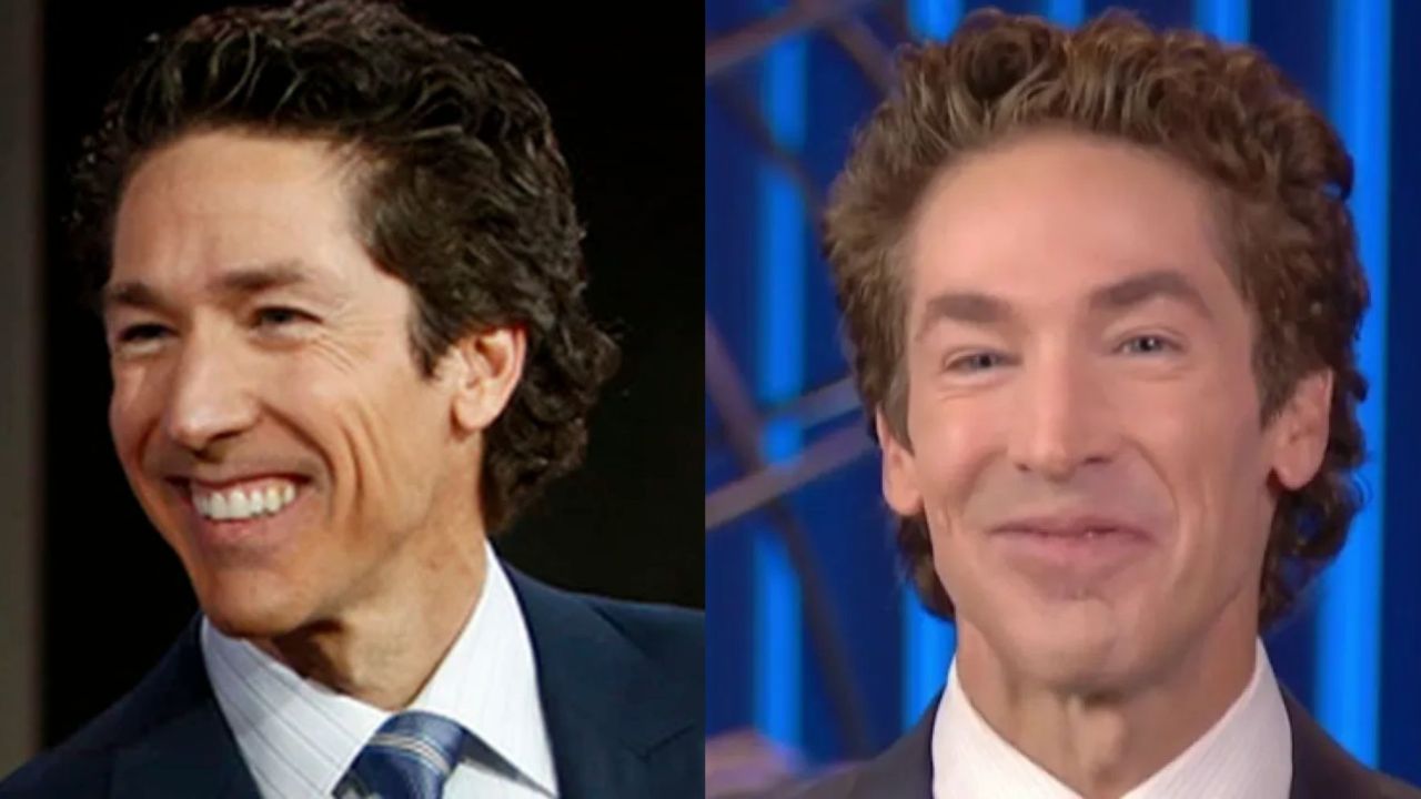 Joel Osteen's Plastic Surgery: The Pastor's Opinions on Cosmetic Surgery; Look at the Before and After Pictures!
