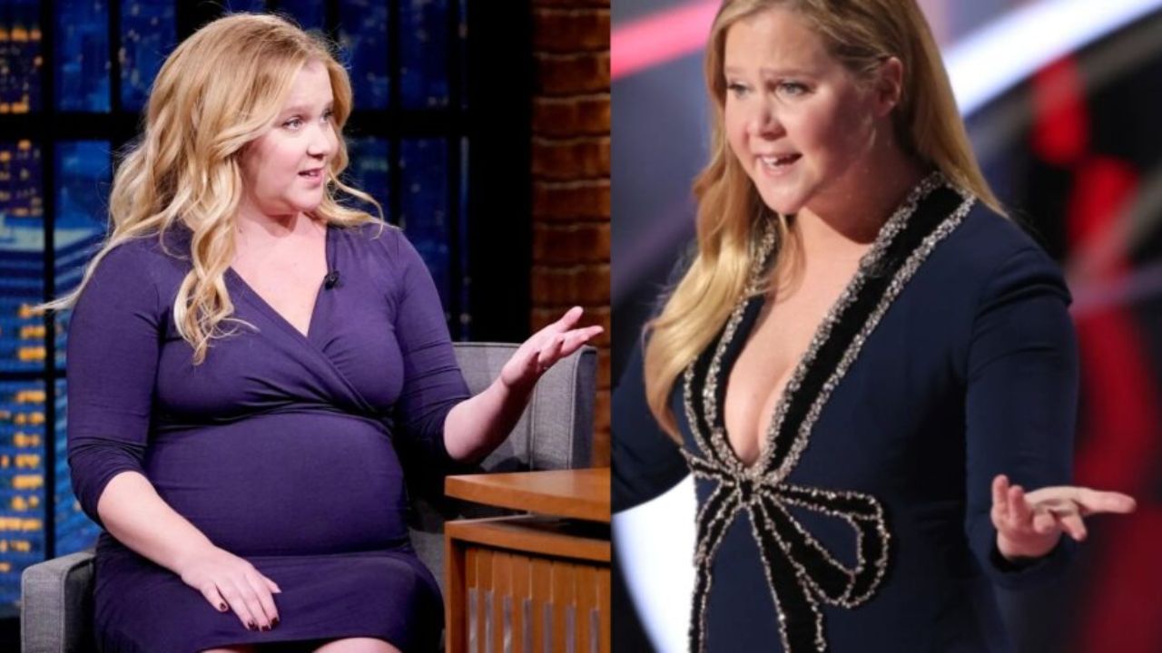 Amy Schumer’s Plastic Surgery: Liposuction and Fillers Explored!