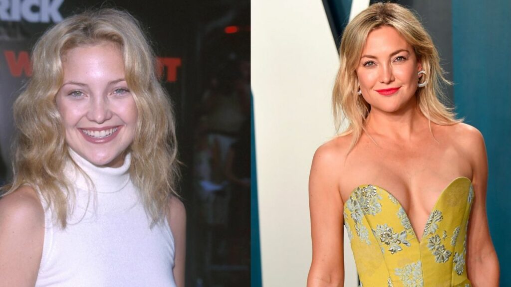 Kate Hudson’s Plastic Surgery: Her Transformation Contrasted with Then and Now Pictures!
