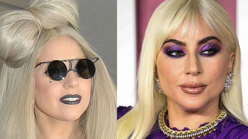 Did Lady Gaga Have Plastic Surgery? The Poker Face Singer Used To Proudly Say She Was Never Tempted to Despite Pressure; Check Out the Before and After Pictures!