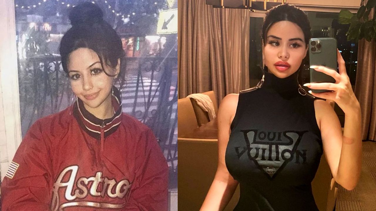 Yungsweetro Before Plastic Surgery: Rojean Kar Looks Eerily Similar to Travis Scott's Baby Mama Kylie Jenner! Fans Seek Before and After Pictures!