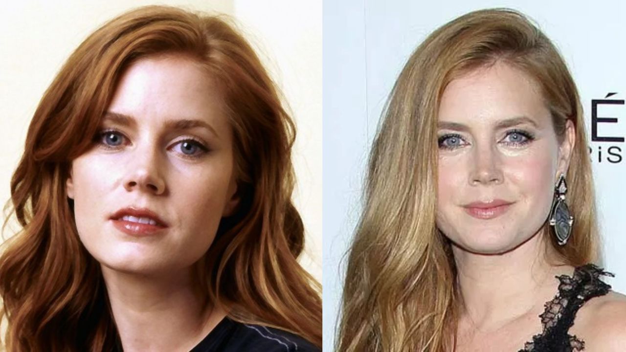Amy Adams' Plastic Surgery: Did The Enchanted Cast Get a Nose Job and Botox?