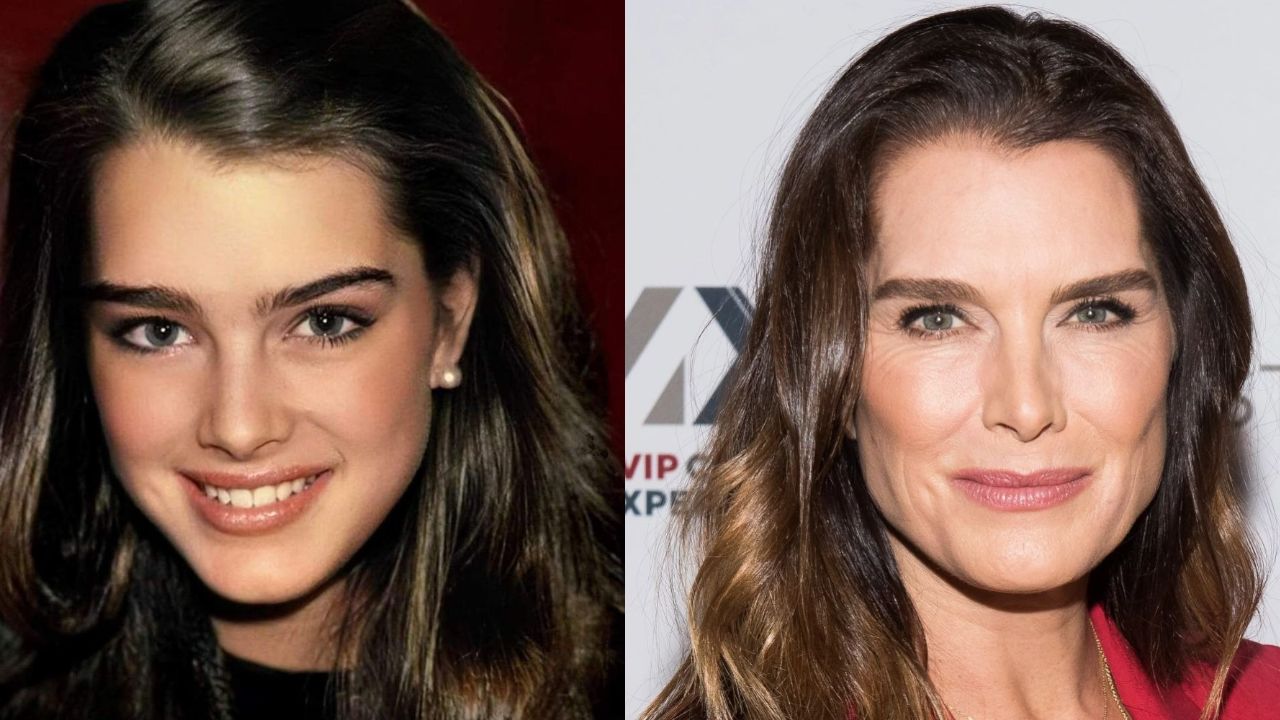 Brooke Shields' Plastic Surgery: How is She Handling Aging Process? The Model Then and Now!