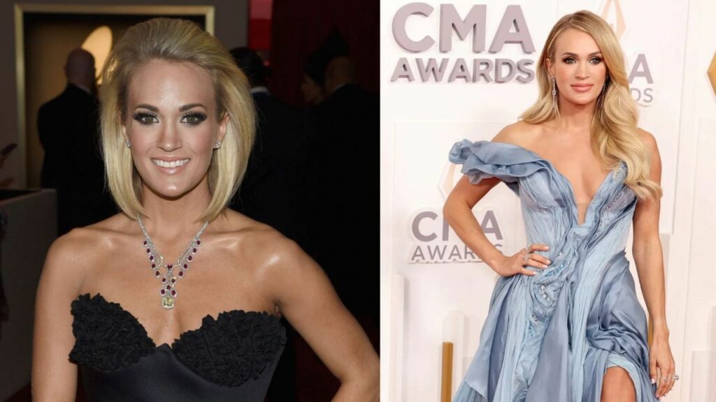 Carrie Underwood’s Lips in CMA 2022: Did She Get Lip Surgery? Does Her Face Hint at Botox & Other Plastic Surgery?