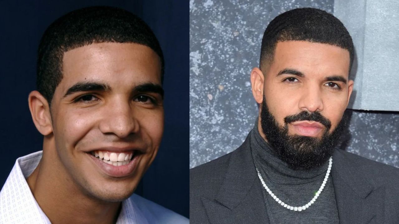 Did Drake Get Plastic Surgery? Did The Rapper Get BBL and Lipo? Rumors of His Fake Abs, Nose Job, and Tummy Tuck Discussed on Reddit!