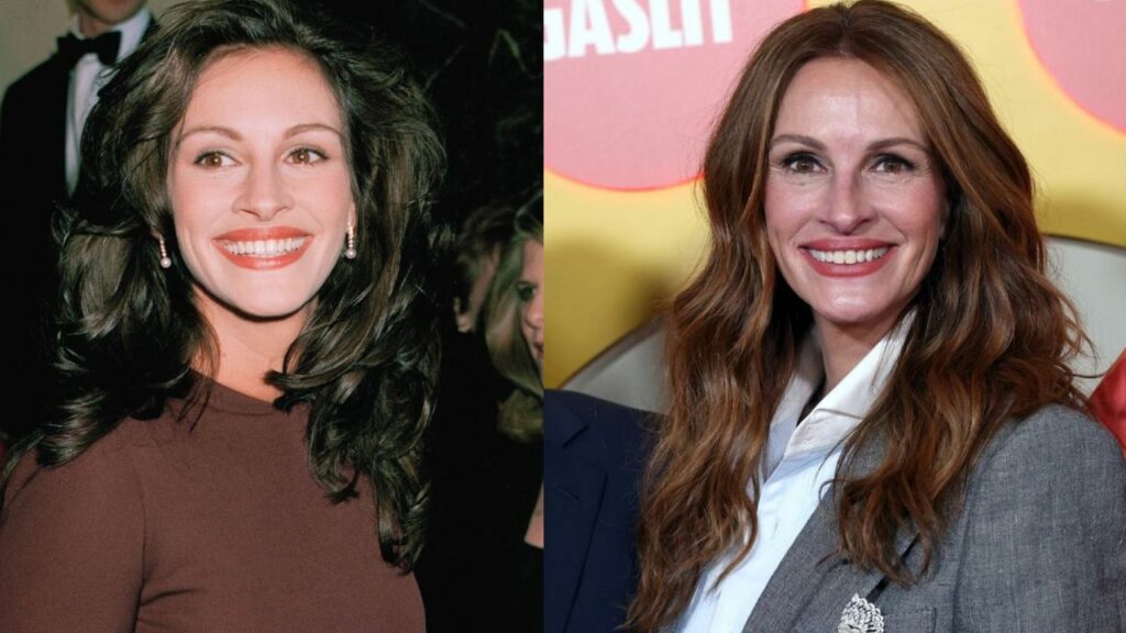 Julia Roberts' Plastic Surgery: What Does The Hollywood Icon Think About Getting Cosmetic Procedures?