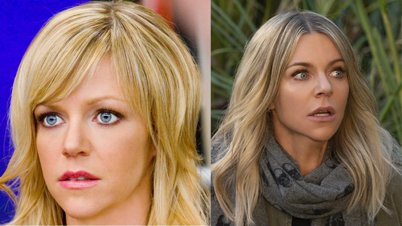 Kaitlin Olson's Plastic Surgery: What Other Procedures Did She Have In Addition to Skull Reconstructive Surgery?