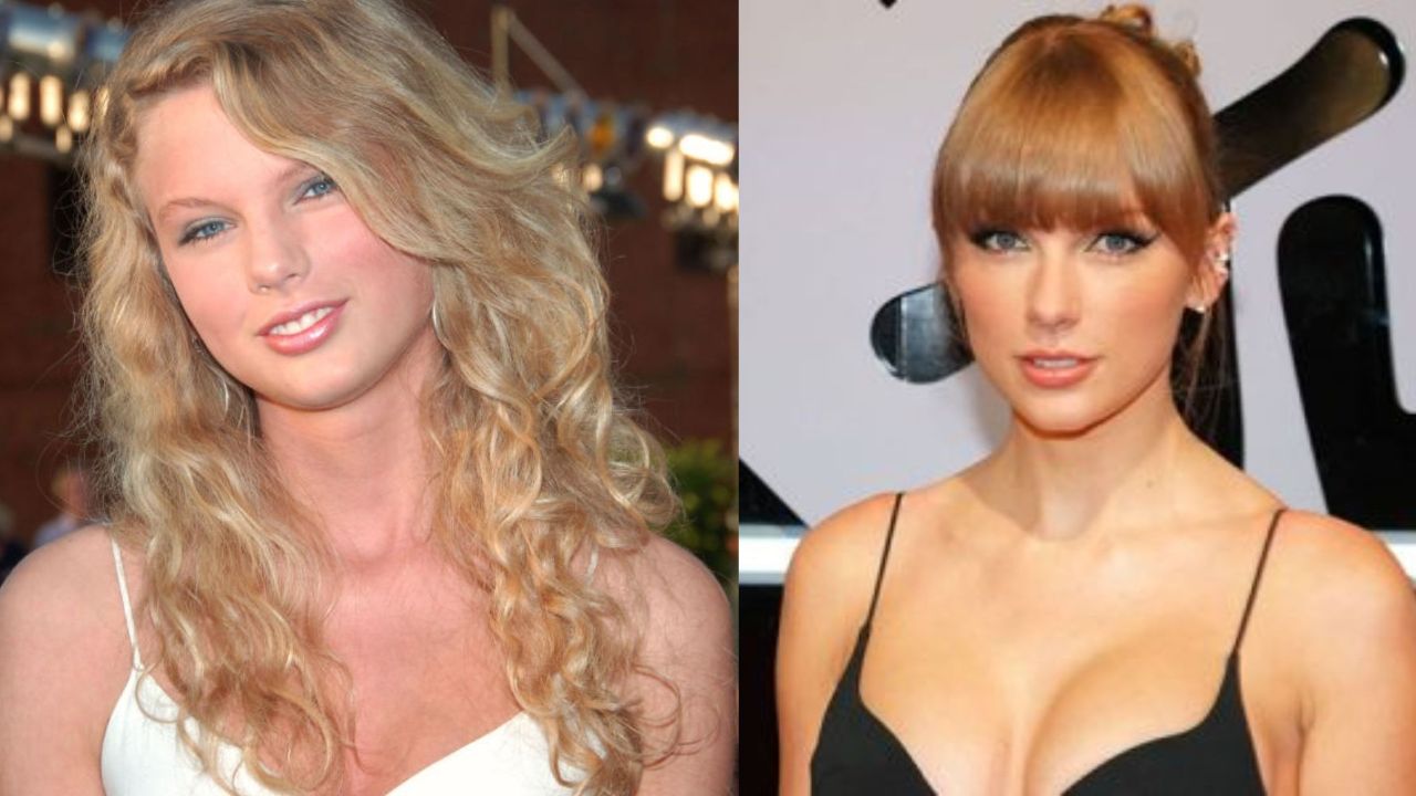 Taylor Swift's Plastic Surgery: Lorry Hill's Analysis of the Singer's Face and Body; Did She Have Breast Implants and Blepharoplasty?