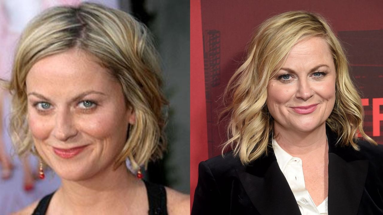 Amy Poehler's Plastic Surgery: What Does The Comedian Think About Getting Cosmetic Treatments?