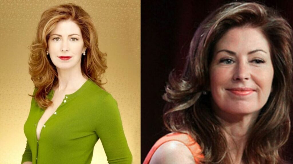 Dana Delany’s Plastic Surgery: The 66-Year-Old Star Is Accused of Having Multiple Cosmetic Treatments!