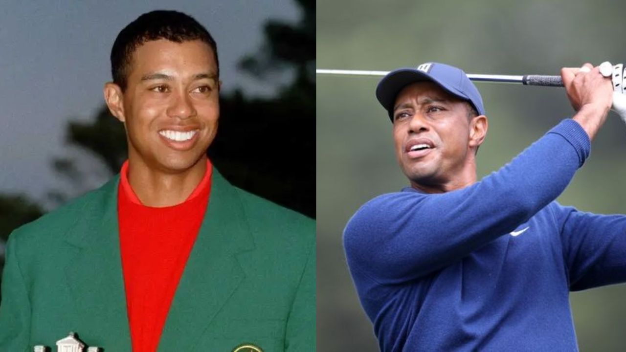 Tiger Woods' Plastic Surgery: What Happened on the 2009 Thanksgiving Night Car Accident?