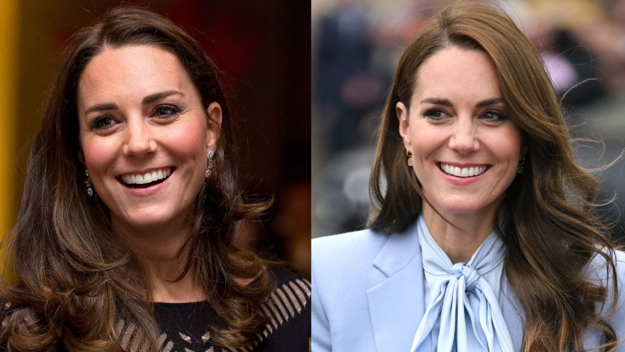 Kate Middleton’s Plastic Surgery: Did the Princess of Wales Undergo Nose Job? Did She Get Her Lips Done in 2022? Recent Photos Examined!