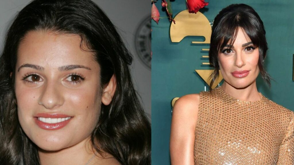 Lea Michele's Plastic Surgery: What Happened to Her Face? Did She Have Jaw Surgery or Buccal Fat Removal?