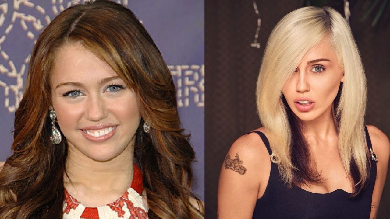 Miley Cyrus' Plastic Surgery: The Singer Looks Different with a New Face; Speculations of Veneers, Nose Job, Buccal Fat Removal and More!