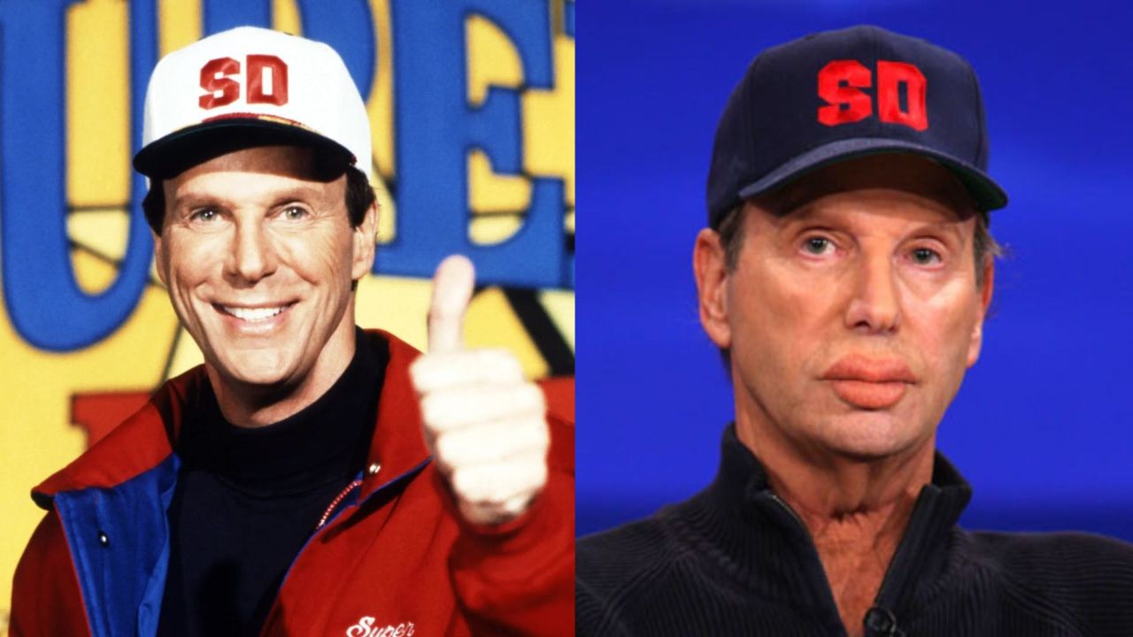 Super Dave's Plastic Surgery: What Happened to Bob Einstein's Lips? Is It Real or Fake?