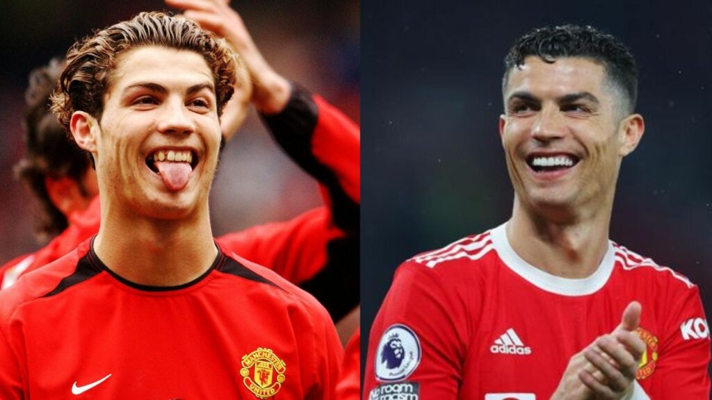 Did Ronaldo Get Plastic Surgery? Why Does His Face Look Different? Did He Get Teeth Surgery? What Did He Do to His Skin?