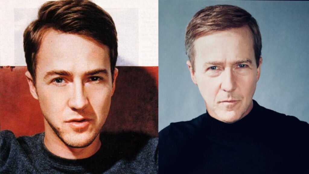 Edward Norton’s Plastic Surgery: Did the Glass Onion Star Have Facelift and Botox to Prevent Aging?