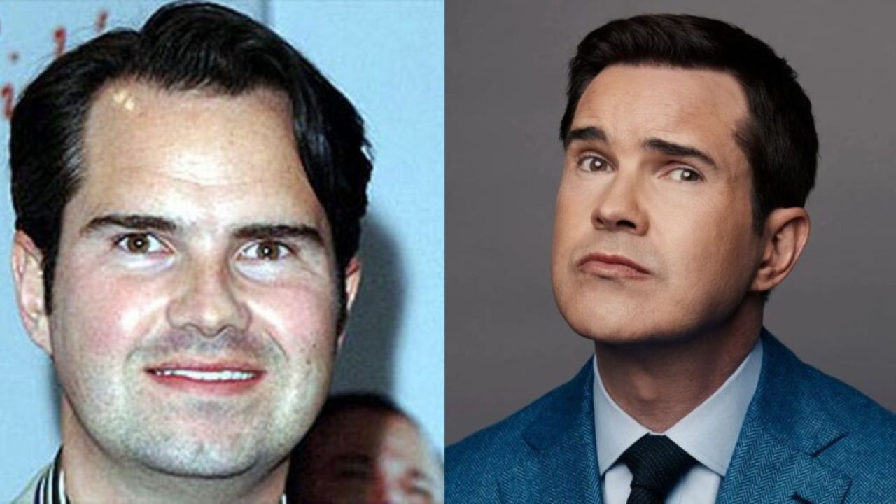 Jimmy Carr’s Plastic Surgery in 2022: How Does the 50-Year-Old Comedian Look So Young Now?